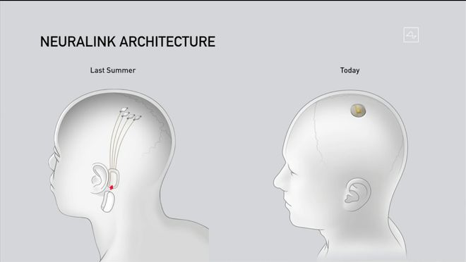 2019年展示的设备位于耳后（左），右侧为最新设备